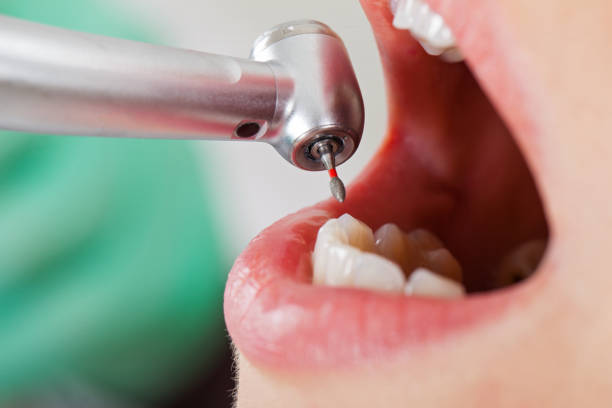 Best Emergency Root Canal Therapy in Crawfordville, FL